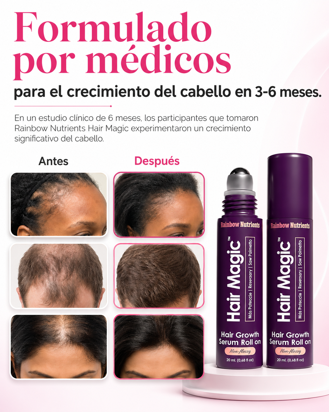Hair Magic™ Serum Capilar para Crecimiento