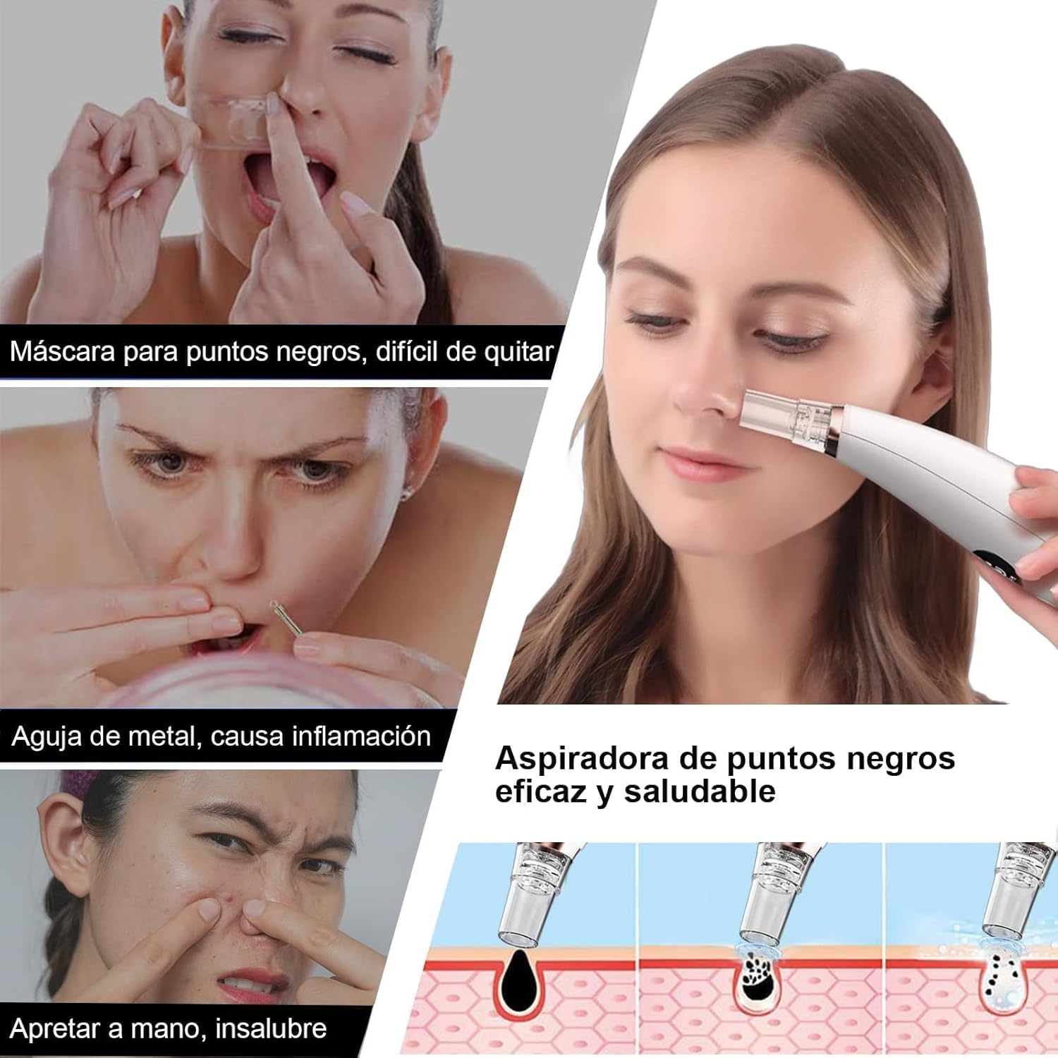 Succionador de Poros Eléctrico